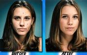 Teen Acne Soaps from Facedoctor: Complete Cure for Teen Acne