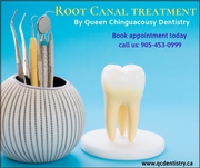 Root Canal Treatment | Best Dentist on Chinguacousy RD