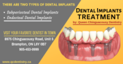 Dental Implant Treatment in Brampton