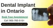 Dental Implants Treatment in Brampton,  Ontario