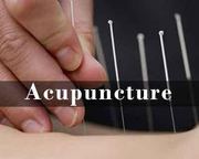 Acupuncture for Arthritis Sinosante Acupuncture Clinic