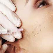 Get the anti aging Botox or Dysport facial treatment today - MDA 