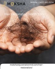 Hair restoration North York