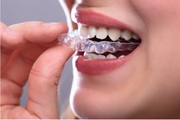 Sports Mouthguards in Calgary